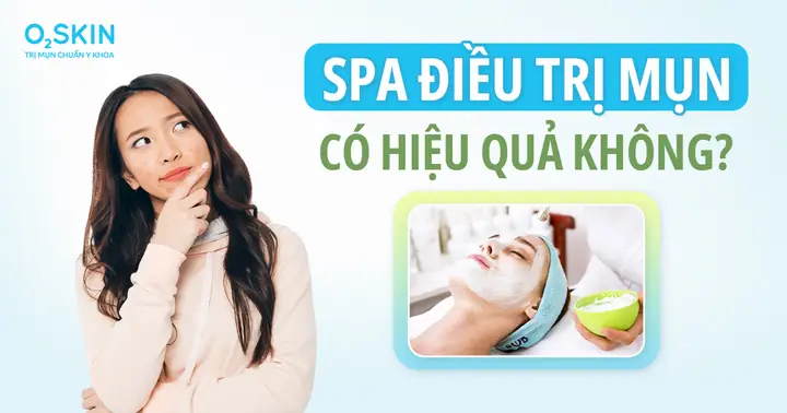 Da Bị Mụn Nên Đi Da Liễu Hay Đi Spa Sẽ Hiệu Quả Hơn? - Phòng Khám ...