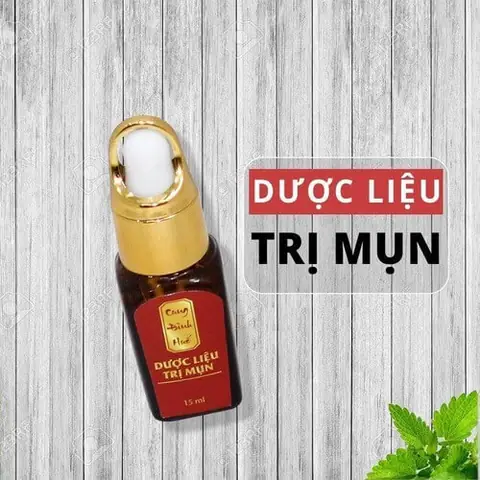 Bộ Trị Mụn Cung Đình Huế Giá Bao Nhiêu?