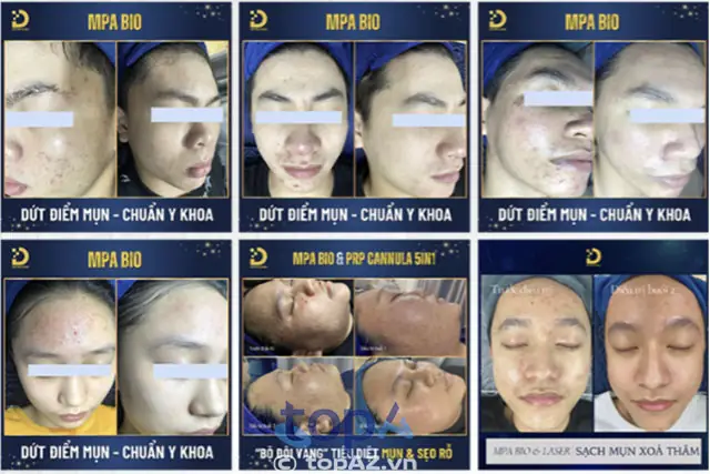 Dr.choice Clinic – Chăm Sóc Da Chuẩn Y Khoa Dr.choice Clinic – Chăm Sóc Da Chuẩn Y Khoa