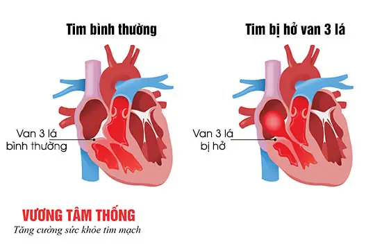 Tìm Thấy Bùa Ngải Ở Tây Ninh: Hướng Dẫn Xử Lý An Toàn Và Hiệu Quả