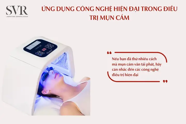 Cách Điều Trị Mụn Cám Chuyên Sâu Như Thế Nào?