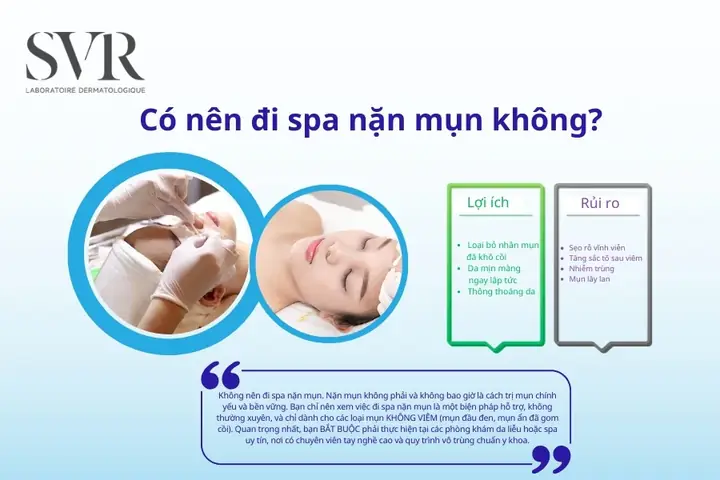 Có Nên Đi Spa Nặn Mụn?
