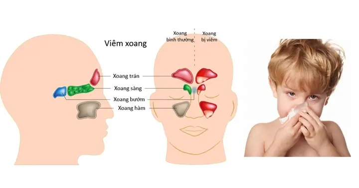 Giao Mùa Thu – Đông (tháng 10 – Tháng 11)